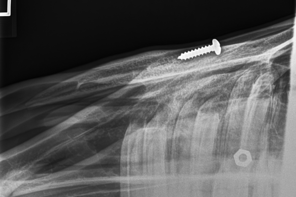 XrayMaxilla2